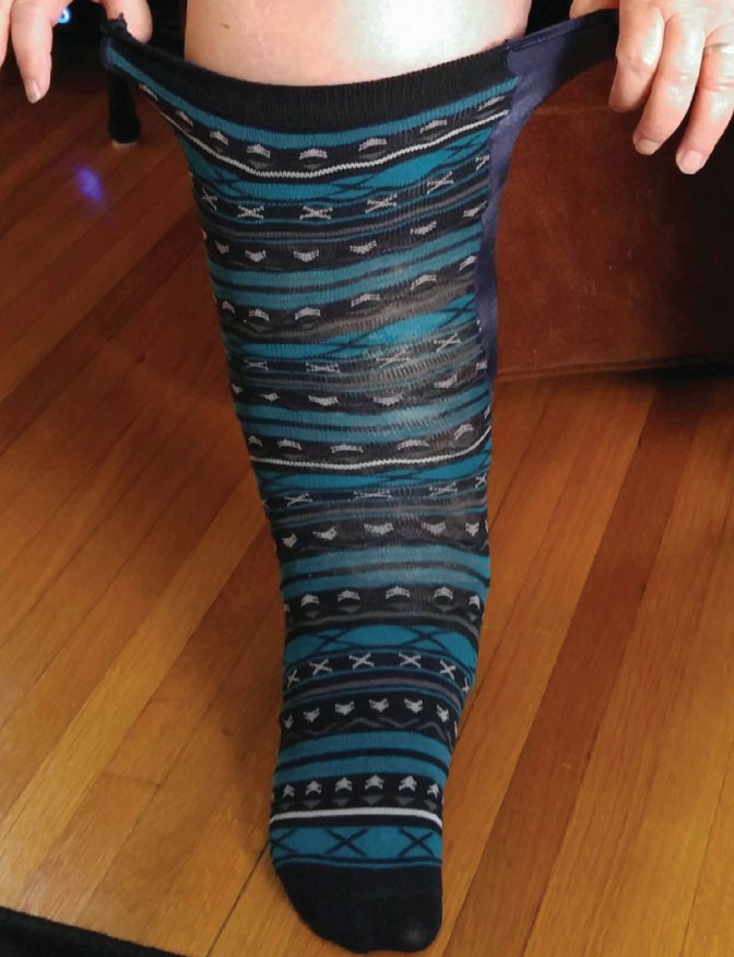 Xpandasox Plus Size/Lymphedema Socks, 24 Inches At Calf, Black - Foto 3